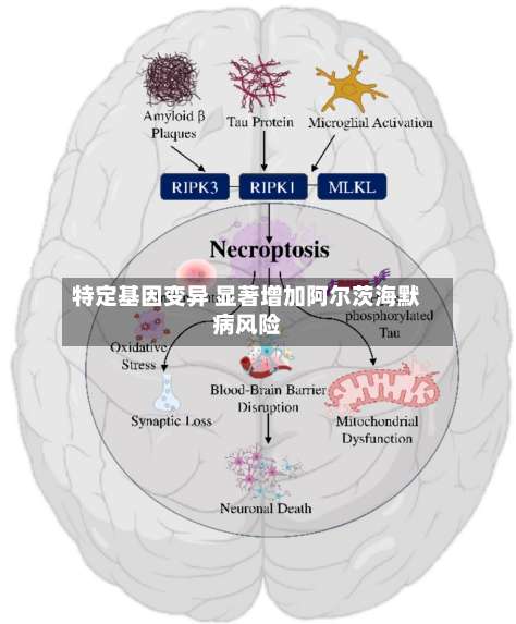 特定基因变异 显著增加阿尔茨海默病风险