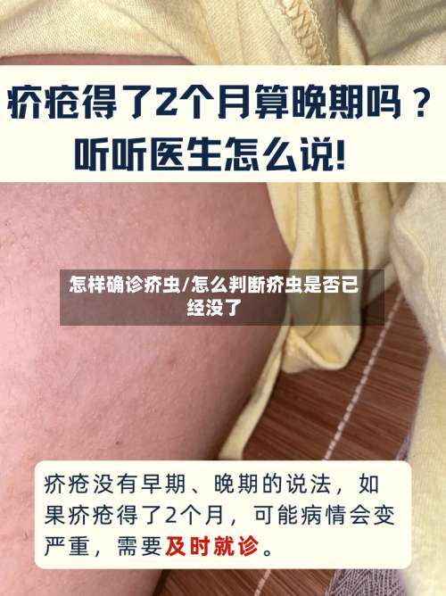 怎样确诊疥虫/怎么判断疥虫是否已经没了-第3张图片